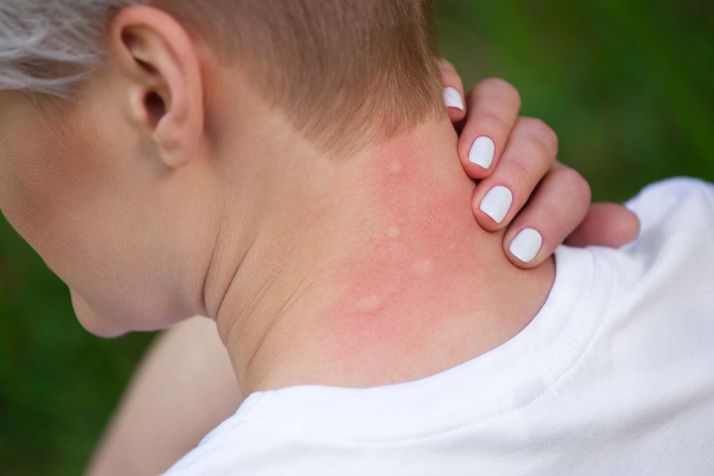 Dengue et voyage: risques et protection